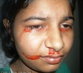 Co be co nuoc mat va mo hoi mau do hinh anh