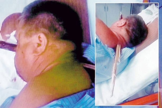 Thanh go dam xuyen dau, nguoi dan ong van tu buoc hinh anh