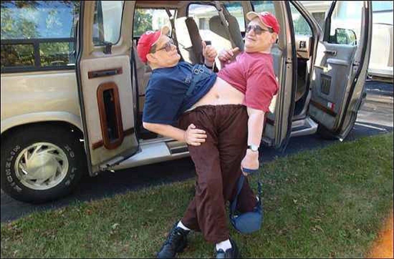 Cặp song sinh dính liền chân. Ảnh: Blogspot.com