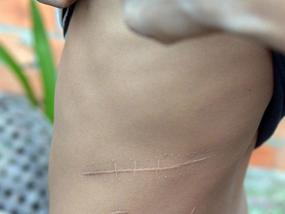 Campuchia thanh mien dat hua cua bon buon noi tang nguoi hinh anh