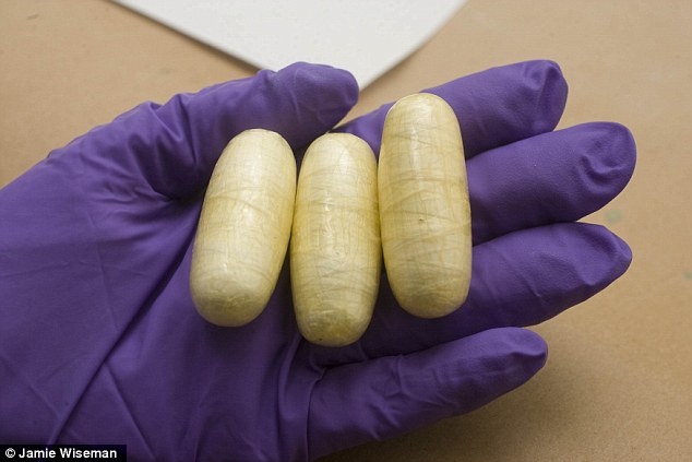 Nu sinh nguy kich vi vien nang ma tuy no trong bung hinh anh