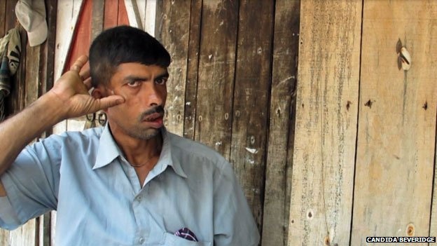 Khuôn mặt của Sukumar Mondol biến dạng sau vụ hổ tấn công