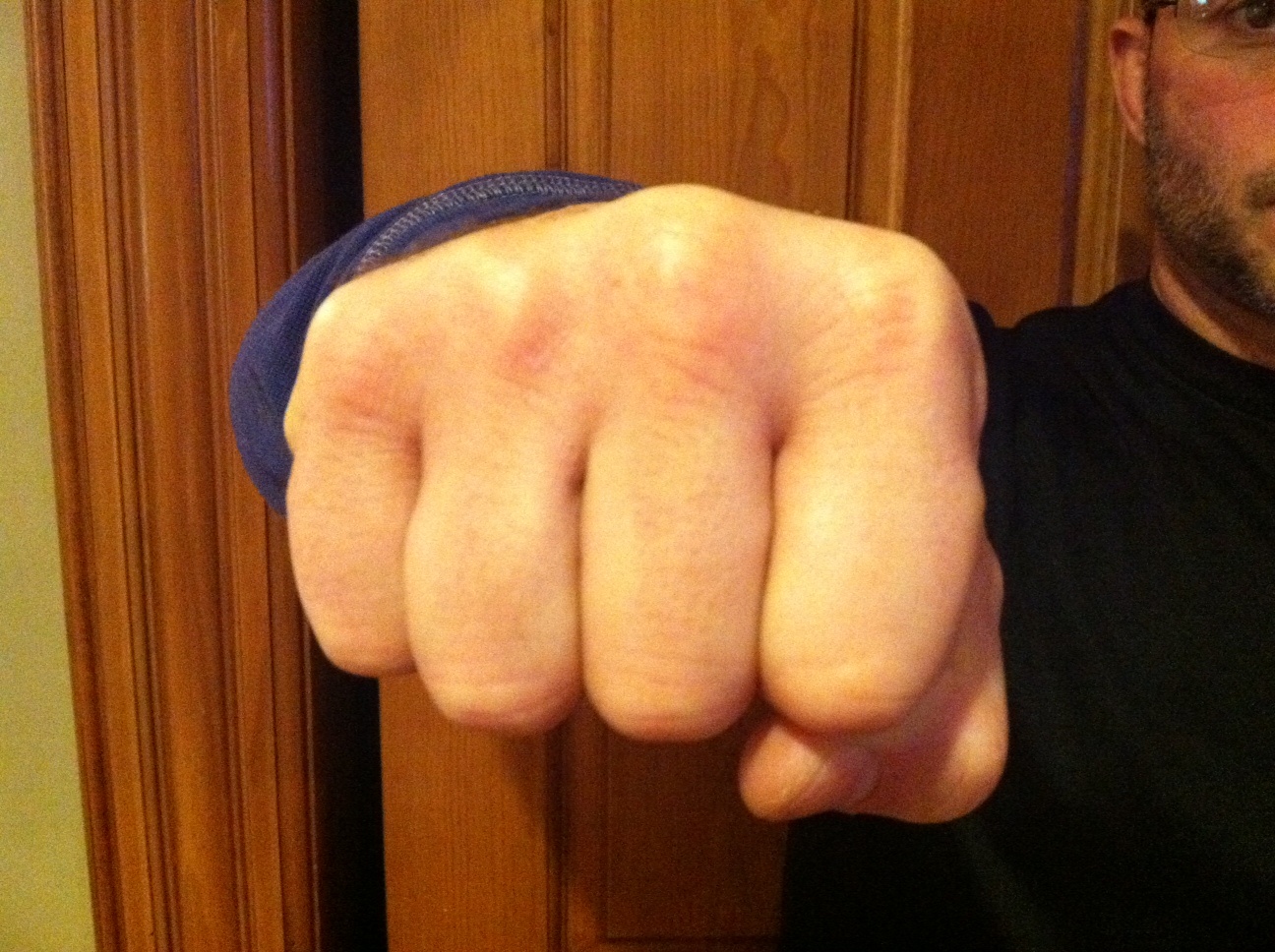 Vo si quyen Anh tung chuong nhu chop de bao ve vo hinh anh