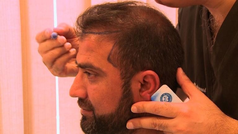 Hoi dau, can benh am anh dan ong Pakistan hinh anh