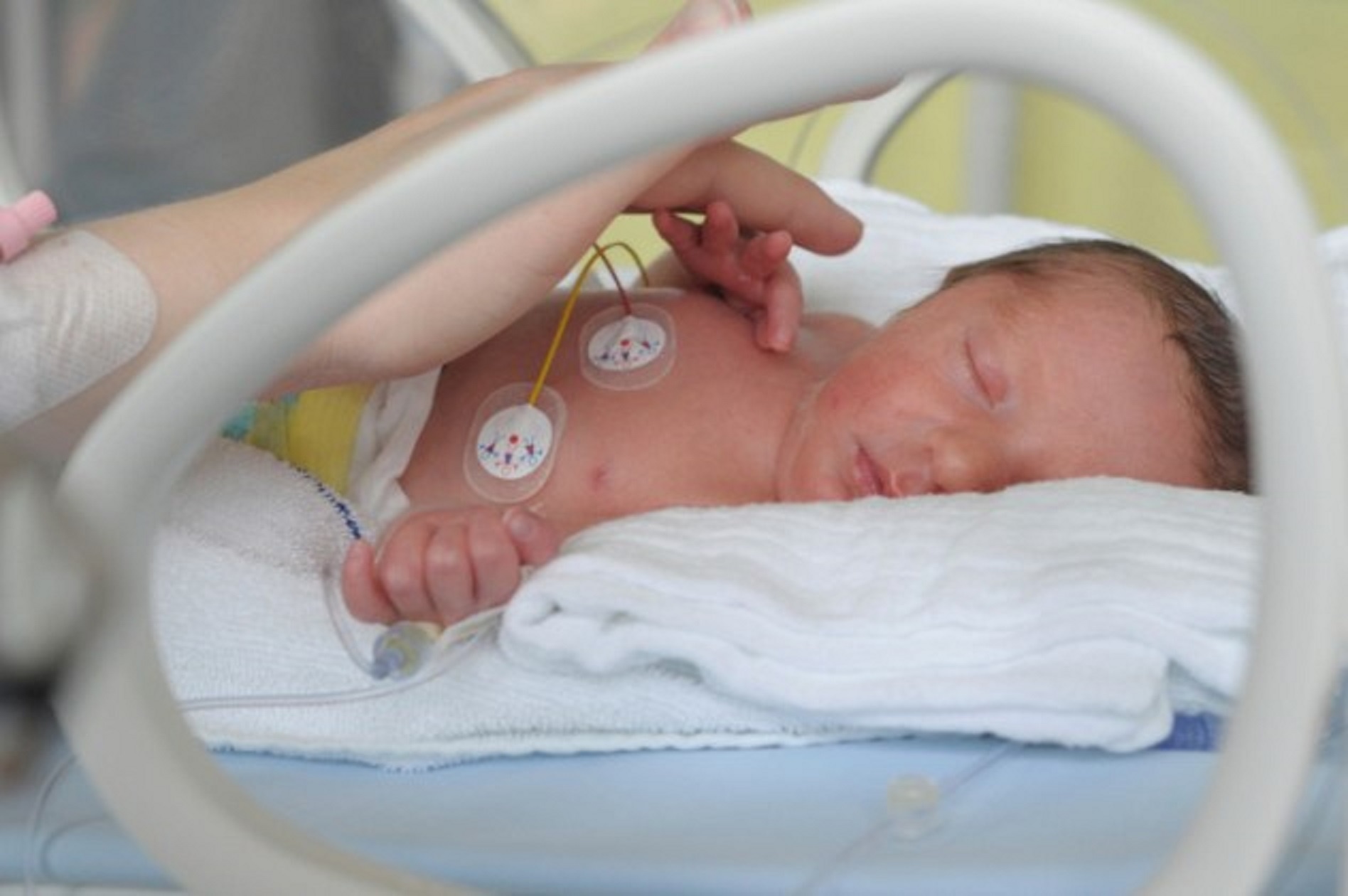 Nhung truong hop tre so sinh thoat chet ky dieu (ky 2) hinh anh