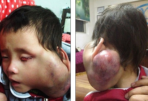 Phu huynh xin bac si giup dua con ung thu tu gia coi doi hinh anh