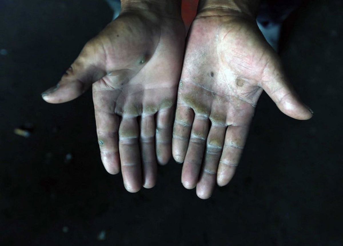 Yang chấp nhận làm nhiều công việc thủ công nặng nhọc như thợ mộc, thợ xây, sửa đường để nuôi sống gia đình.Công việc khiến bàn tay ông chai sạn.