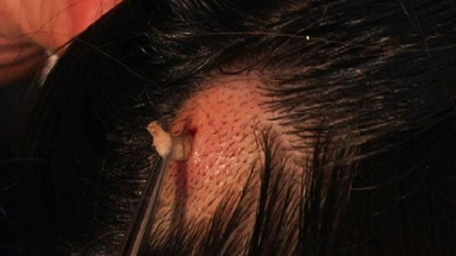 Canh bac si gap au trung ra khoi dau co gai hinh anh