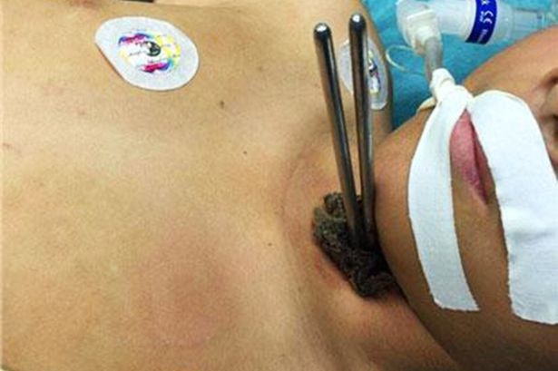 Hoc sinh thoat chet sau khi dua dam qua co hinh anh