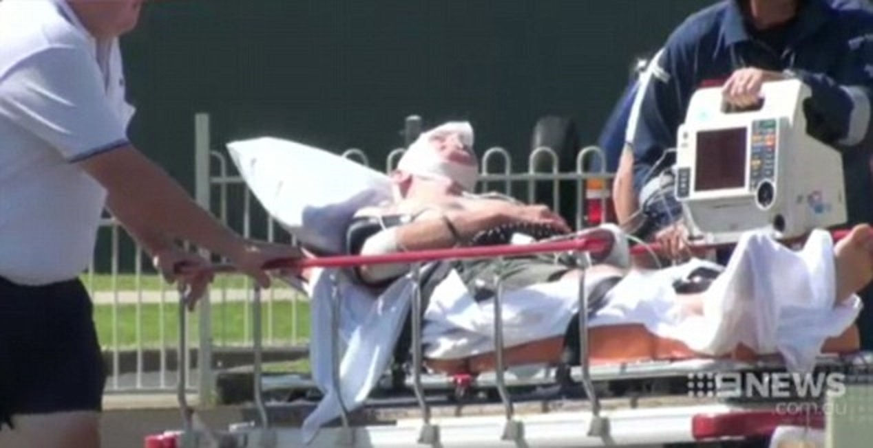 Ca sau can cut ngon tay, loi chu vuon thu xuong nuoc hinh anh