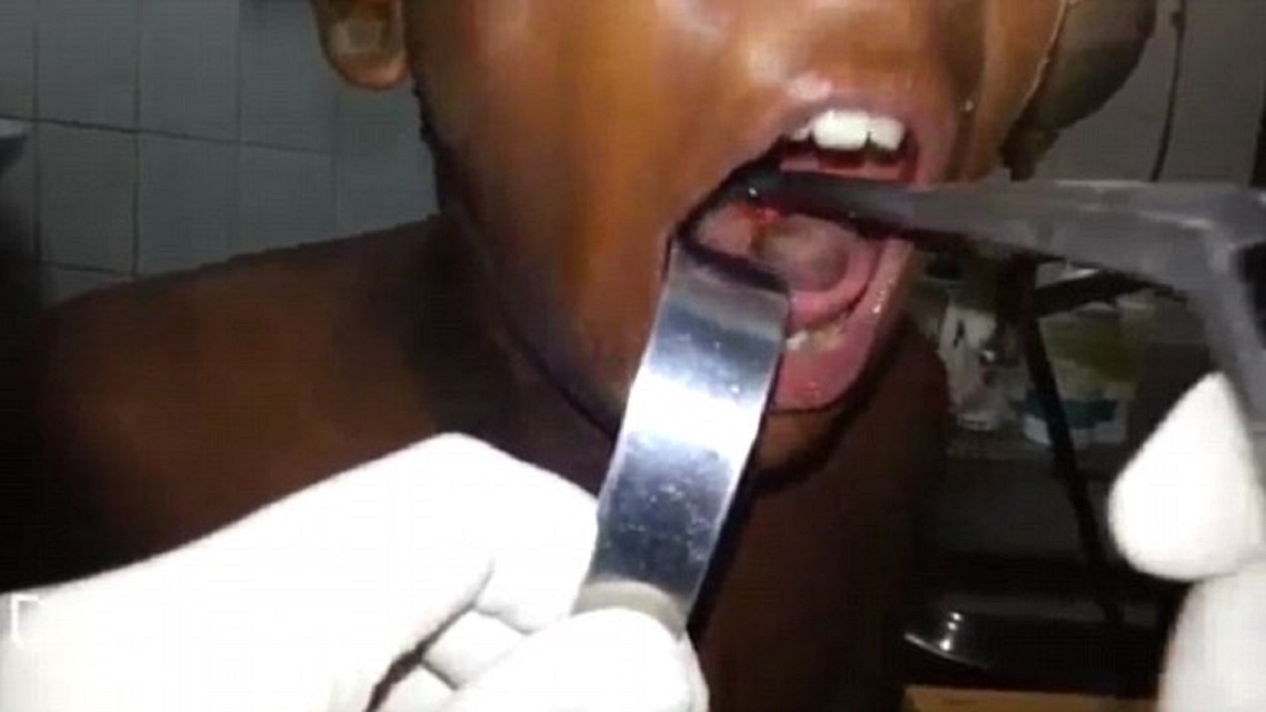 Thieu nien suyt chet vi ca song ket 5 gio trong khi quan hinh anh