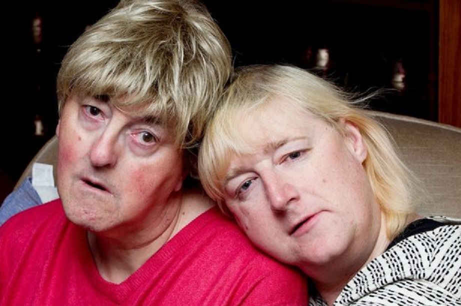 Hai người đang kêu gọi quyên góp để tổ chức hôn lễ vào tháng 2/2015. Ảnh: SWNS