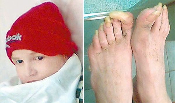 Năm 2007, nhân viên bệnh viện phát hiện cậu bé đang nằm trên một chiếc ổ, làm từ cành cây và lá, trong hang ổ của bầy sói ở Kaluga, Nga. Họ đặt tên cậu bé là Lyokha. Lyokha có nhiều đặc điểm giống một con chó sói: Móng chân cong hình vuốt, hàm răng sắc nhọn, dáng đi giống sói. Lyokha được xác định khoảng 10 tuổi. Cậu bé đã trốn khỏi bệnh viện chỉ trong vòng 24 giờ.