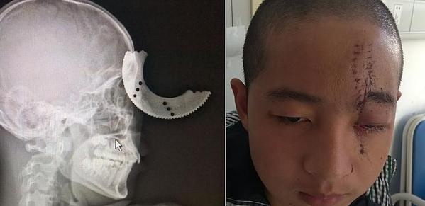 Thanh nien thoat chet du luoi cua gam vao tran hinh anh