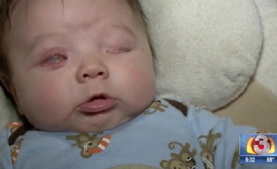 Be so sinh khong co nhan cau vi benh la hinh anh