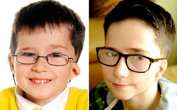 Bien sun xuong suon thanh vanh tai trai hinh anh