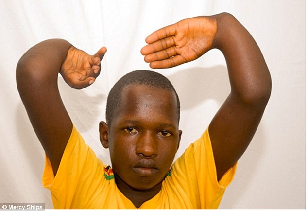 Thieu nien co doi 'tay quy' vi benh bi an hinh anh