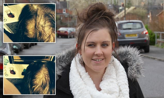 Dau hoi vi nhuom toc qua nhieu hinh anh