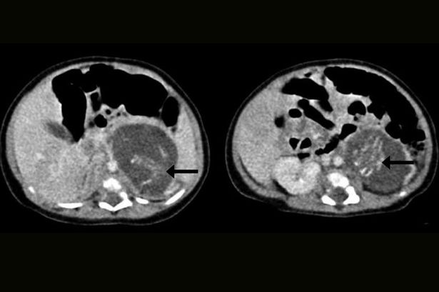 Be gai vua chao doi da mang thai doi hinh anh