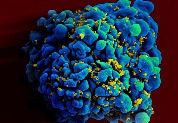 Tim ra vac xin phong HIV? hinh anh