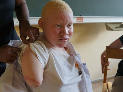 Phan doi cua co gai bach tang bi chat tay khi ngu hinh anh