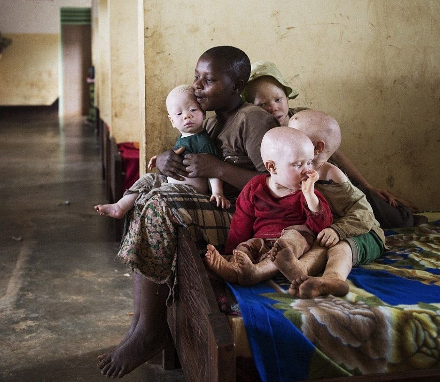 Cuoc song thap thom cua nhung 'than bat tu' o chau Phi hinh anh