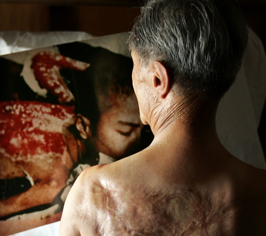 Ky uc thuong tam ve hai vu nem bom nguyen tu hinh anh