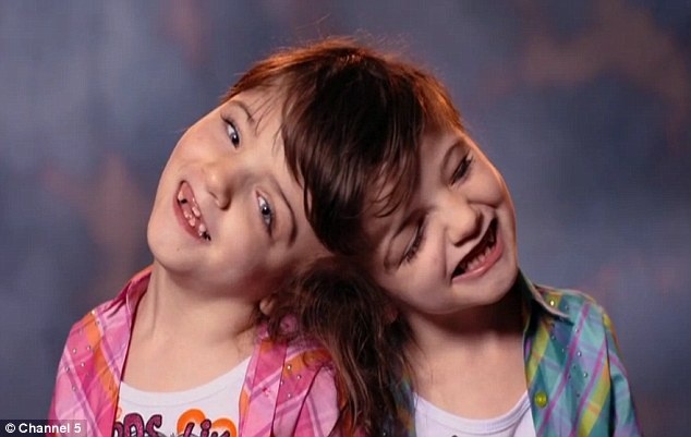 Cap song sinh dinh dau co kha nang nhin bang mat cua nhau hinh anh