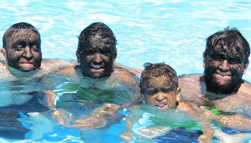 Noi kho cua gia dinh mac hoi chung Nguoi soi hinh anh