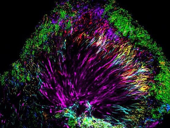 Hinh anh vi khuan ton tai tren rang va khoang mieng hinh anh