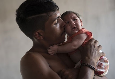 WHO ban bo tinh trang khan cap toan cau ve virus Zika hinh anh