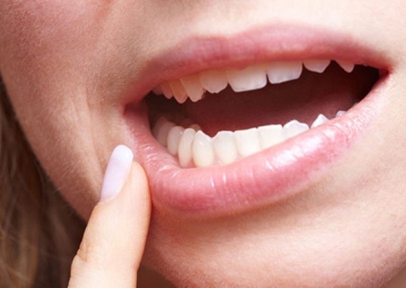 Nhung bieu hien chung to ban can gap bac si da lieu hinh anh