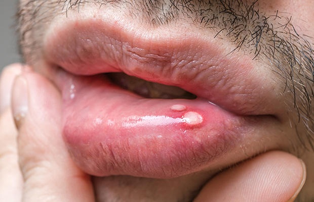 bệnh da liễu,  tóc rụng nhiều,  phát ban ảnh 1 benh da lieu,  toc rung nhieu,  phat ban anh 1