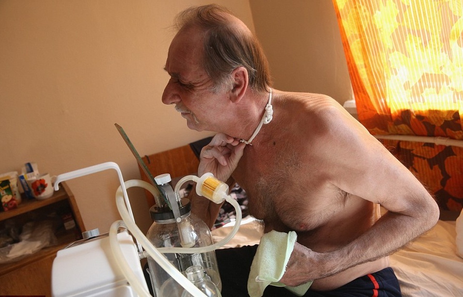 tham hoa hat nhan Chernobyl anh 11