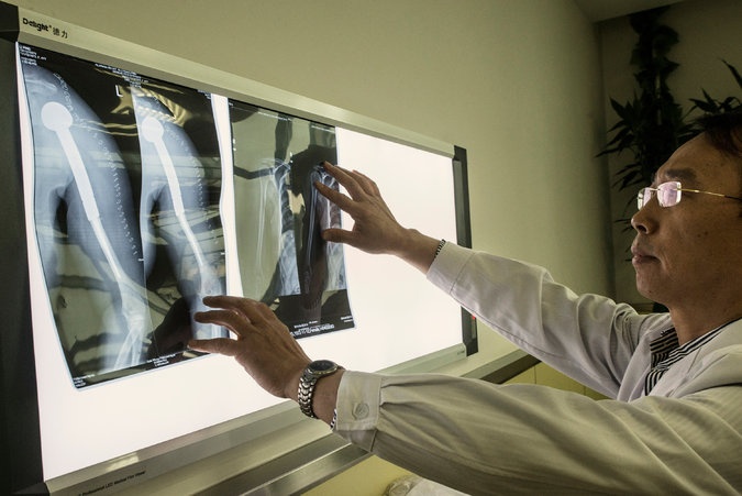 bác sĩ Trung Quốc định cấp ghép cơ thể ảnh 1 bac si Trung Quoc dinh cap ghep co the anh 1