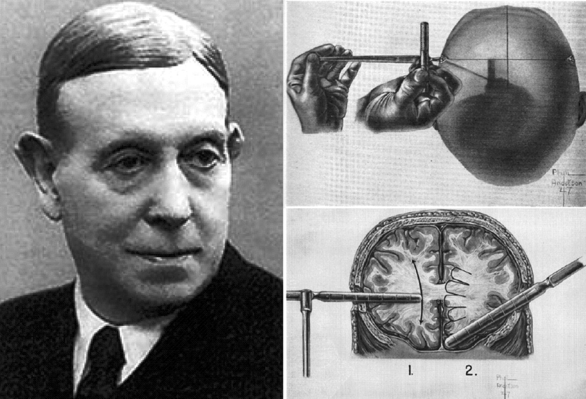 Nhung giai Nobel bi 'trao nham' trong lich su hinh anh