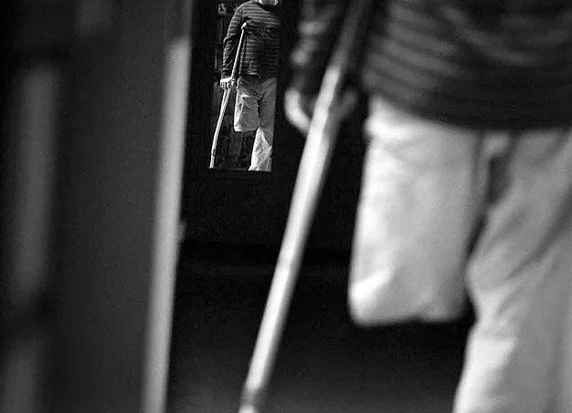 Nhung vu cat bo tay chan tren the gioi anh 2