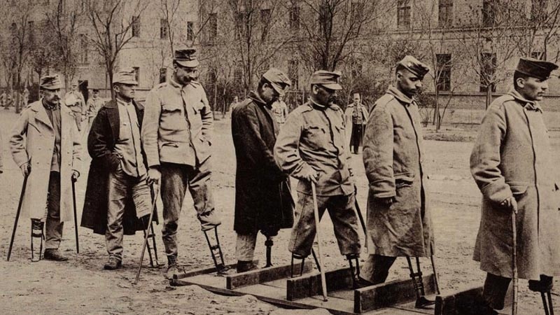 Nhung vu cat bo tay chan tren the gioi anh 1