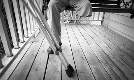 Nhung vu cat bo tay chan tren the gioi anh 3