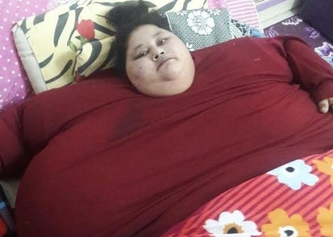 Nguoi phu nu nang nhat the gioi duoc phau thuat giam can hinh anh