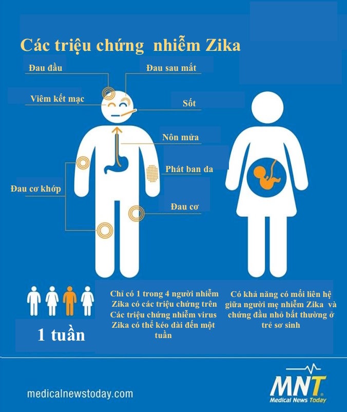 những điều cần biết về dịch virus teo não Zika ảnh 2 nhung dieu can biet ve dich virus teo nao Zika anh 2