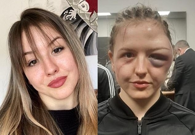 nu vo si quyen anh anh 1