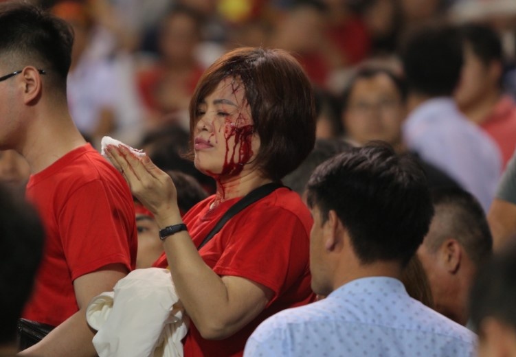 CDV danh nhau do mau trong tran Viet Nam gap Indonesia hinh anh