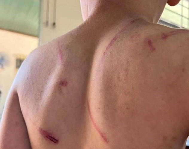 bé trai bị bố và bà nội bạo hành ảnh 1 be trai bi bo va ba noi bao hanh anh 1