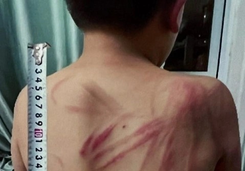 Bat khan cap nguoi cha hanh ha con ruot o Da Lat hinh anh