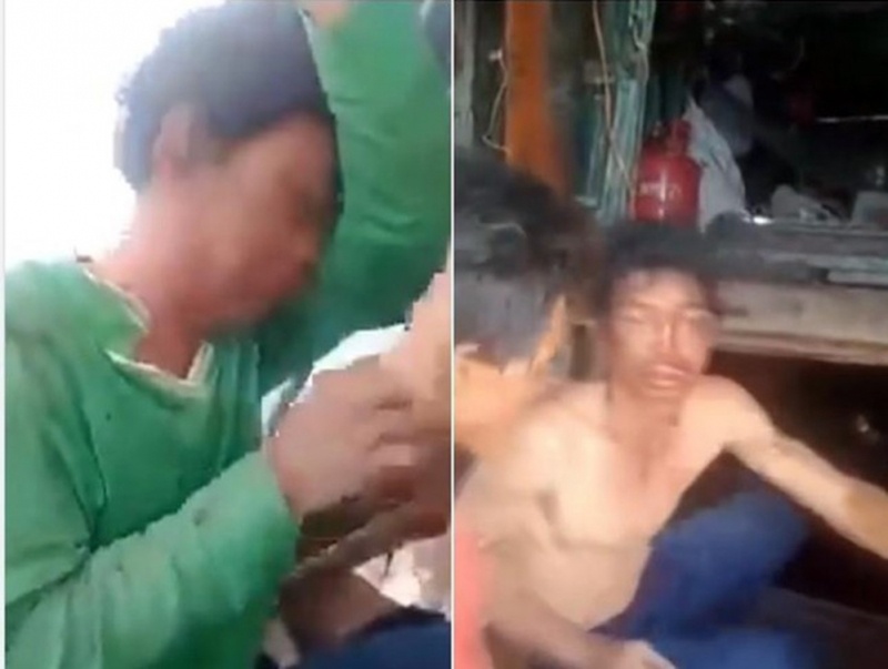 Vu nguoi dan ong bi tra tan tren tau ca: Cung cap ho so dieu tri benh hinh anh