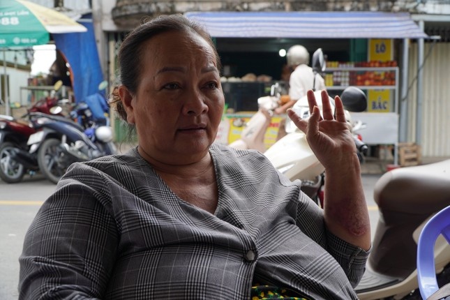 Giam doc Cong an Vinh Long noi ve vu nguoi phu nu bi nem bom xang hinh anh