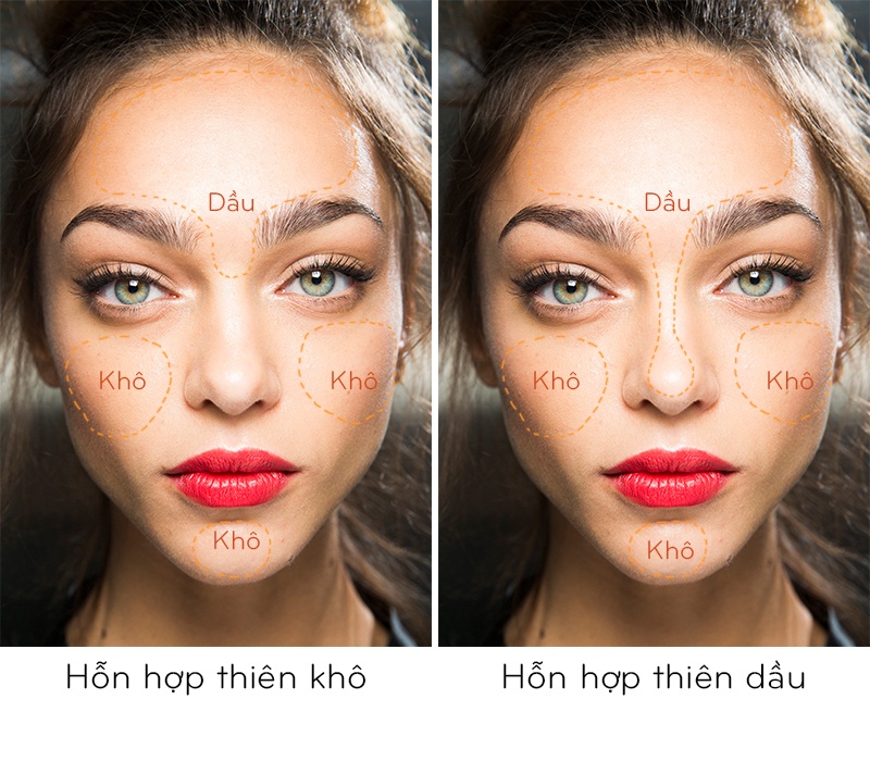 nguyen nhan gay mun anh 3