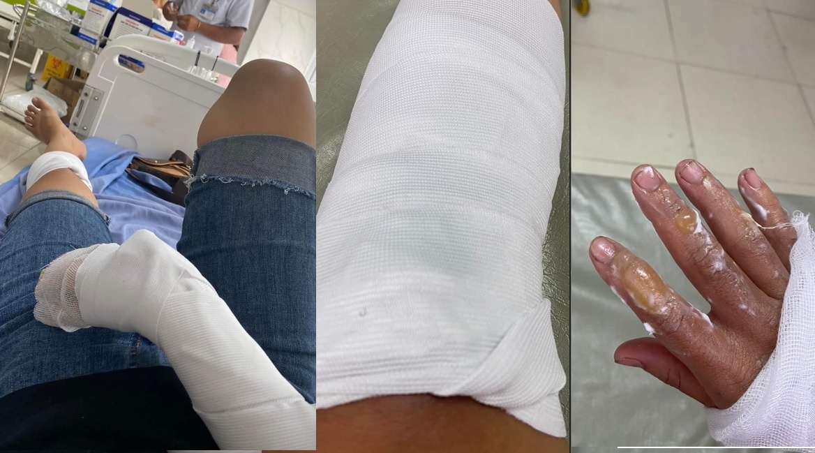 no binh gas mini anh 1