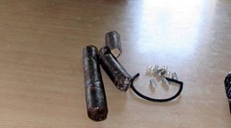 Mot nguoi o Quang Ninh bi thuong nang do no min tu che danh ca hinh anh